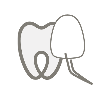 Icon Veneers for front teeth